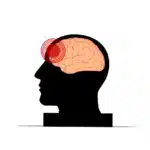 A black silhouette of a human head in profile, with a light pink brain inside and red concentric rings over the forehead, symbolizing pain or impact.
