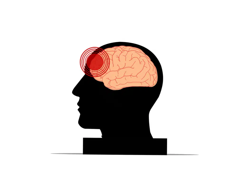 A black silhouette of a human head in profile, with a light pink brain inside and red concentric rings over the forehead, symbolizing pain or impact.
